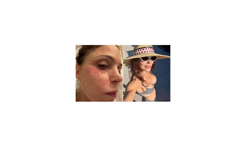 Bethenny Frankel Blames Hotel Towels for St. Barts Bacterial Infection