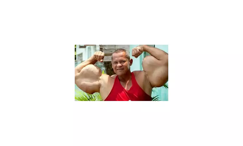 Brazilian Bodybuilder 'Popeye' Dies at 55 After Renal Failure