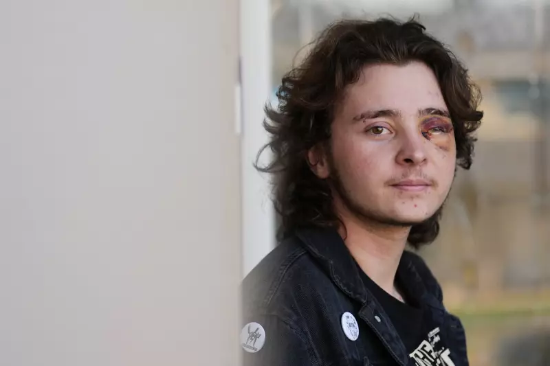 California Protester Blinded in One Eye Amid String of Federal Agent Violence