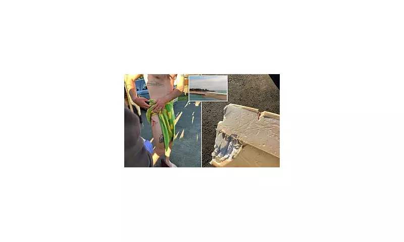 California Surfer, 26, Survives Shark Attack After Predator Rams His Board