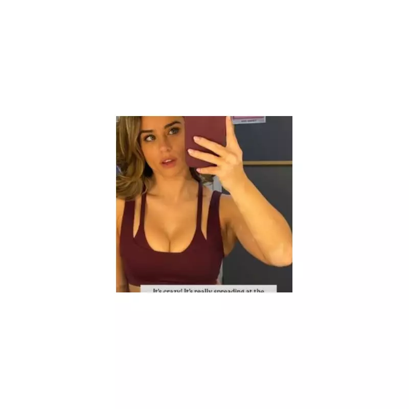 Coronation Street's Georgia May Foote shares vitiligo update: 'Winter is easier'