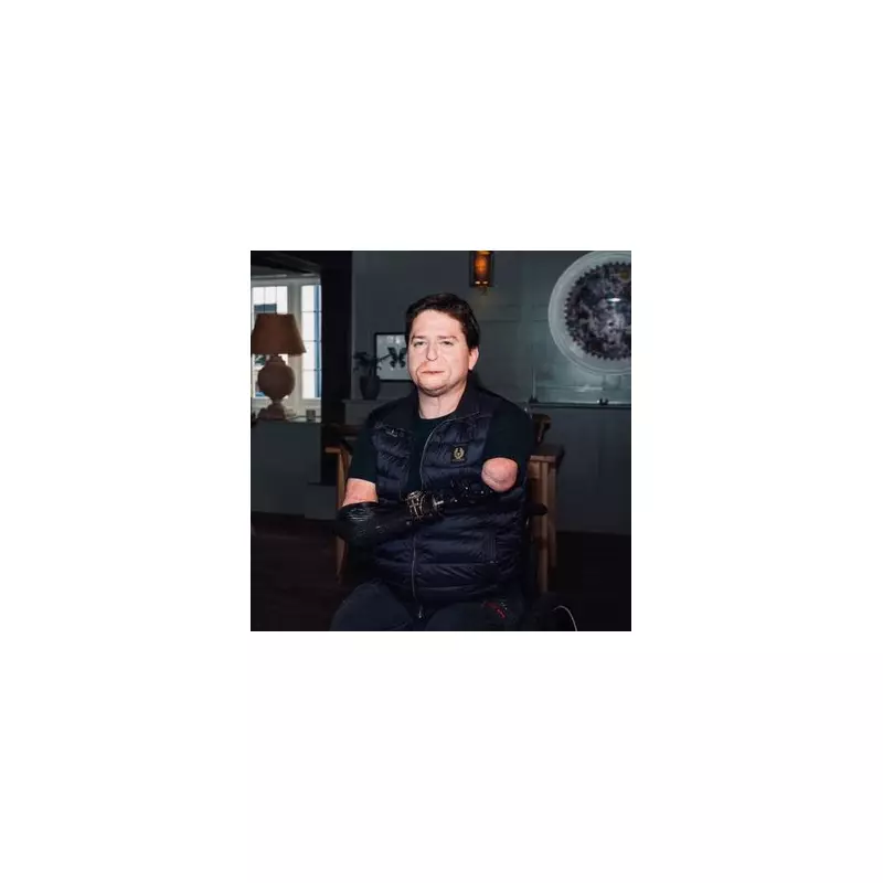 Dad's Purple Skin Led to Limb Loss After Strep A Misdiagnosed as Flu