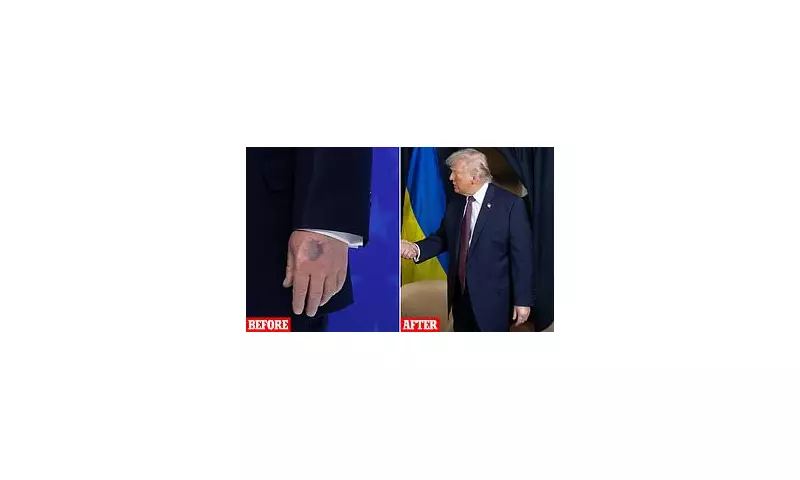 Donald Trump's Bruised Hand Concealed with Makeup at Davos Forum Sparks Health Questions