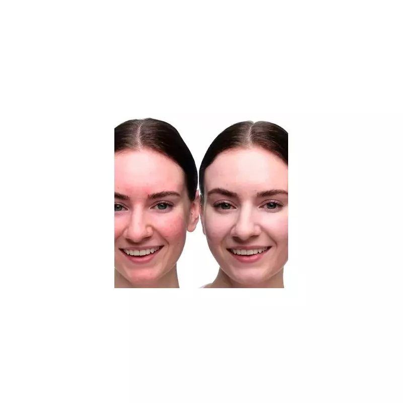 Dr Jart+ Rosacea Cream Praised as 'Lifesaver' Now Just £10 in Boots Sale