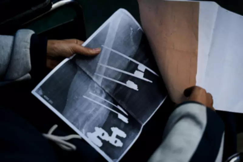 Gaza Teen's Hope for Walking Again Hinges on Rafah Border Opening