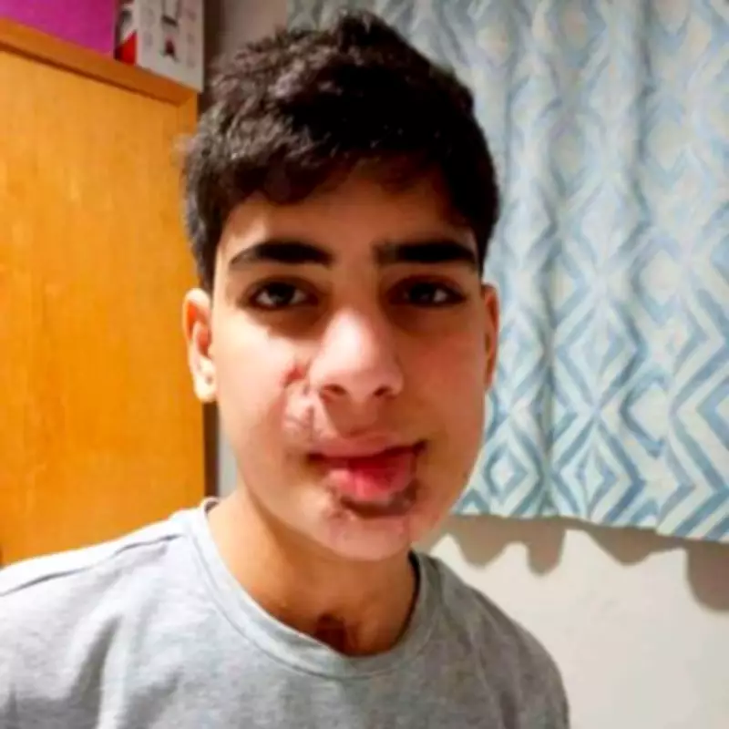 Gaza Teen's Smile Restored by NHS Surgeon After Devastating Blast Injury