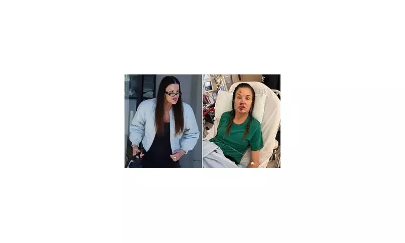 Janice Dickinson's First Public Sighting After Revealing I'm A Celeb Injury Scars