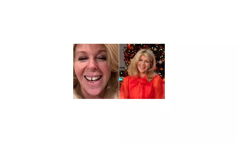 Kate Garraway's Dental Disaster: GMB Star Glues Teeth Before Live Show