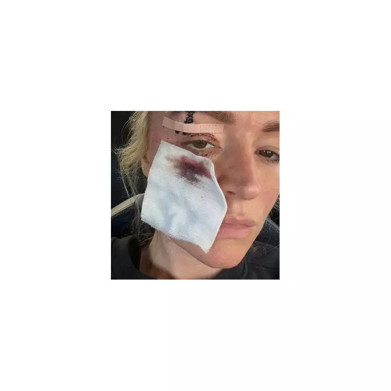 Laura Woods Shares Graphic Photos of Facial Injuries After 2024 Accident