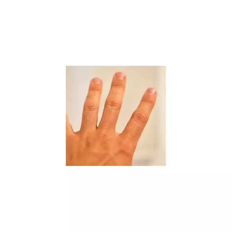 Lung Cancer Warning: The Finger Clubbing Symptom You Must Not Ignore