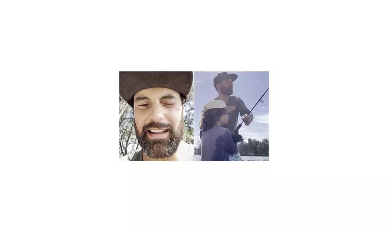 MAFS Star Cameron Merchant's Fishing Horror: Hook Pierces Eyelid