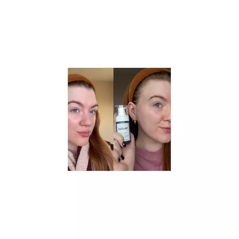 Medik8's New Niacinamide Peptides Serum Tackles Redness & Texture in 10 Days