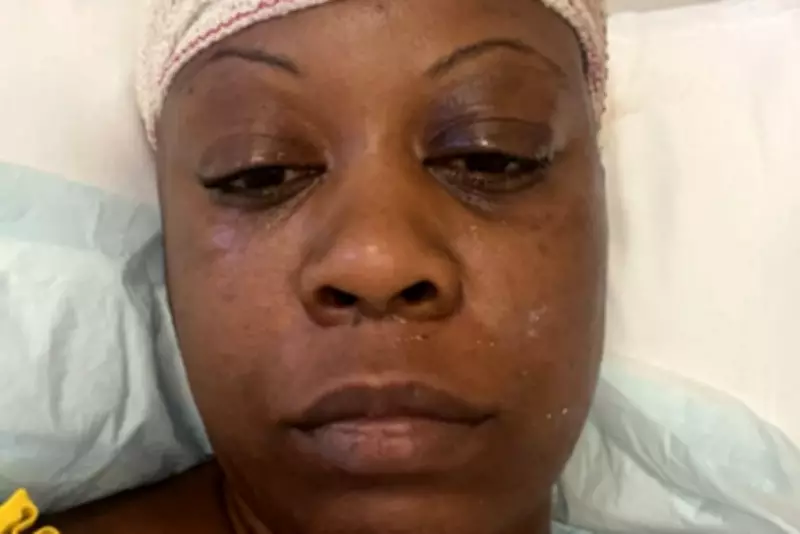 Mother's Stroke Nightmare: How High Blood Pressure Nearly Killed Her Twice