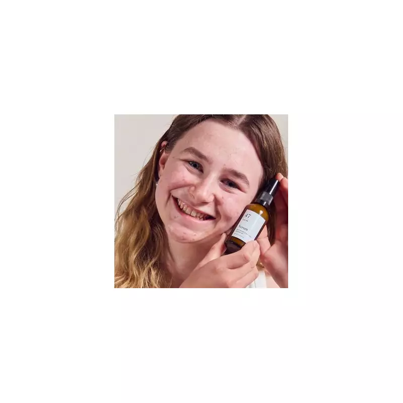 Mum's £29 solution for teen's acne restores confidence and family photos