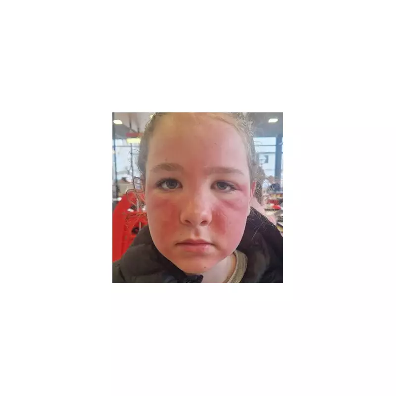 Mum's Horror as Daughter's Face Peels After Using Primark Cleanser