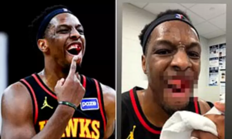NBA Star Onyeka Okongwu Suffers Gruesome Dental Injury After Jaylen Brown Elbow