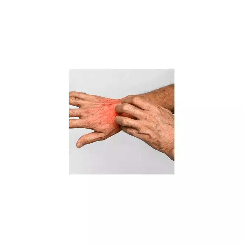 Scabies Cases Surge 20% Across UK as Victorian-Era Skin Infection Returns