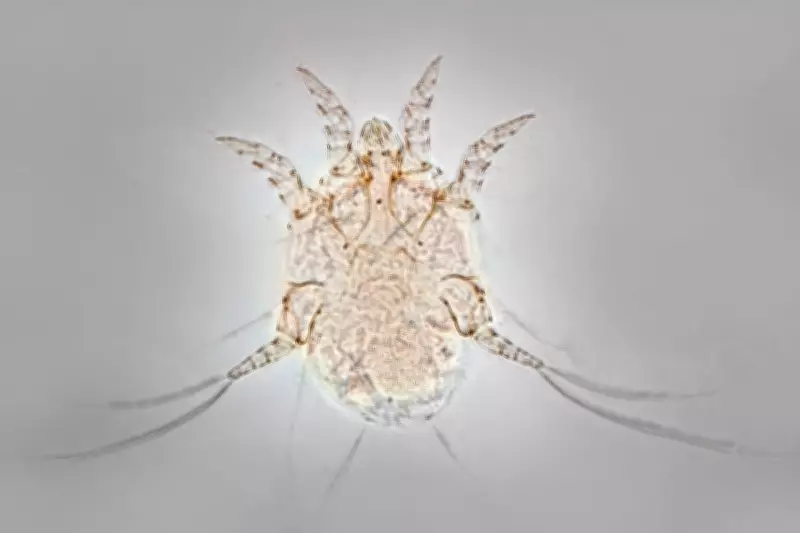 Scabies Surge Sweeps UK and Europe: Understanding the Skin Mite Epidemic