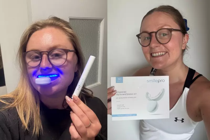 SmilePro Teeth Whitening Kit Review: Visible Results in 30 Minutes at Half Price