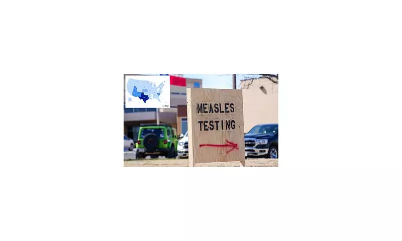 South Carolina Measles Outbreak: Over 100 New Cases in a Week