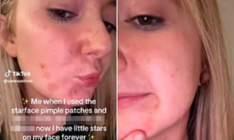 Starface Pimple Patches Leave Painful Marks as 'Sephora Kids' Skincare Trend Raises Alarm