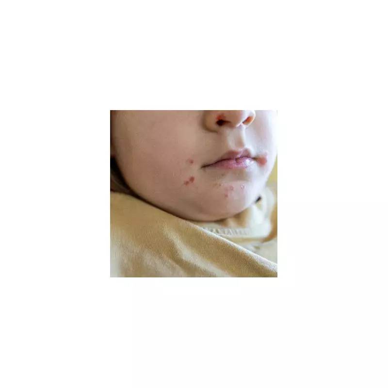 Superdrug Pharmacist Issues 'Stay Home' Alert Over Misdiagnosed Skin Infection