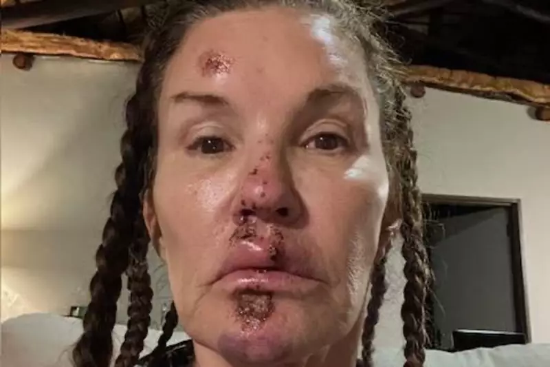 Supermodel Janice Dickinson sues I'm A Celebrity for £700k over permanent facial injuries