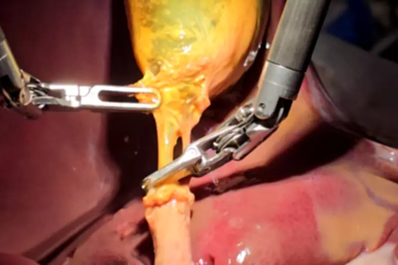 Surgeons Perform Remote Operations from 1,700 Miles Away in Landmark Study