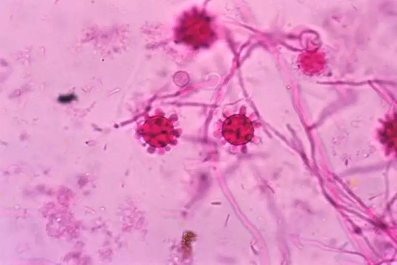 Tennessee Fungal Outbreak Claims Life as Health Officials Race to Contain Infections