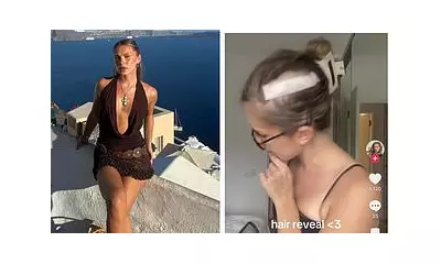 Ex-Home and Away Star Alea O'Shea, 25, Reveals Brain Cancer Treatment Paralysis