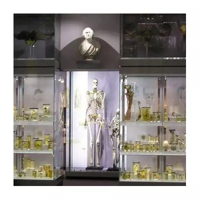 Inside London's Hunterian Museum: A Stark Warning Over Its Jars of Human Remains