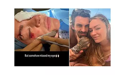 Laura Woods reveals horrific eye injury from romantic getaway accident