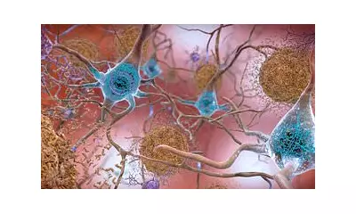 Long Covid Brain Fog Linked to 60% Rise in Alzheimer's Protein, Study Warns