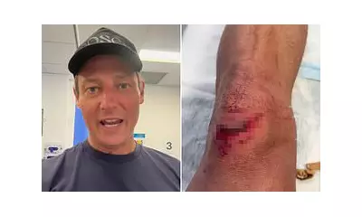 Merrick Watts' 2026 Starts with Hospital Dash After Gruesome Running Injury