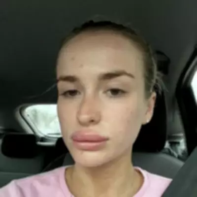 Woman's Body Covered in Rash After Doctors Dismiss Symptoms for Years