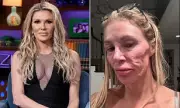 Brandi Glanville Reveals New Look After Facial Diagnosis Journey