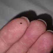 Dad's Premier Inn Stay 'Ruined' by Flea Bites and Poor Cleanliness