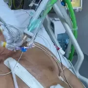 Father's Dental Visit Leads to Life-Threatening Heart Infection and 18-Hour Surgery