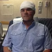 Hunter Survives Grizzly Bear Attack by Shoving Arm Down Its Throat