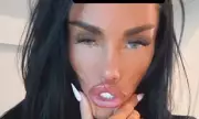 Katie Price Unveils New Lip Fillers and Plans BBL Surgery After Split