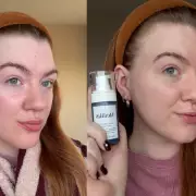 Medik8's New Niacinamide Peptides Serum Tackles Redness & Texture in 10 Days