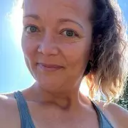 Mum, 42, chooses leg amputation after family dog attack in Tennessee