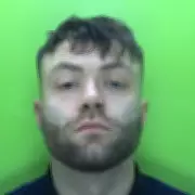 Nottingham Man Jailed for Torturing XL Bully Puppy with Cigarette Burns and Broken Bones