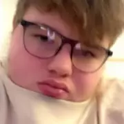 Police Mistake: 'Dead' Teen Wakes from Coma, Reveals Identity Mix-Up After Rotherham Crash