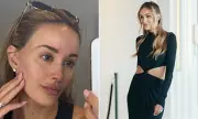 Rebecca Judd's Anti-Ageing Secrets: Lasers, Injections & Weekly Alcohol Limit