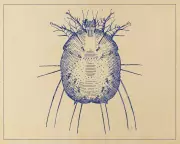 Scabies Outbreak in UK: Cases Soar 44% as Sufferers Describe 'Hellish' Ordeal