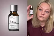 The Ordinary's 'Filler in a Bottle' Serum Tested: My Results After One Month