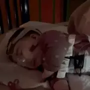 Three Babies Die Annually as NHS Delays £5 SMA Screening Test