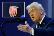 Trump Defies Doctors, Blames 'Big Aspirin' for New Hand Bruise at Davos