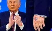 Trump Reveals Bruise Origin: Davos Table Clip and High-Dose Aspirin Regimen